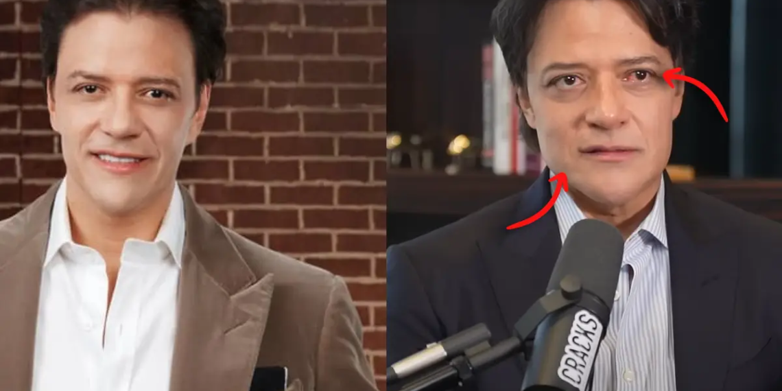 Usuarios preocupados por el aspecto físico de Rodrigo Herrera culpan a su dieta