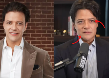 Usuarios preocupados por el aspecto físico de Rodrigo Herrera culpan a su dieta